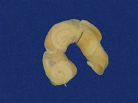 茶斑蛇藏品圖，第15張